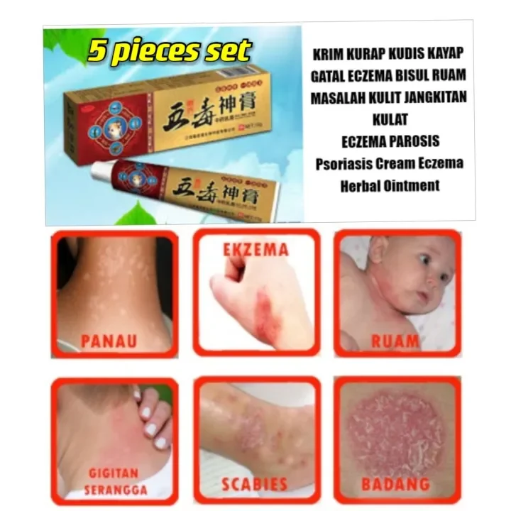 5 Pieces Set Krim Kurap Gatal Kudis Buta Celah Kangkang Panau Jangkitan Kulat 五毒神膏植物草药祛痒皮癣菌膏 Lazada